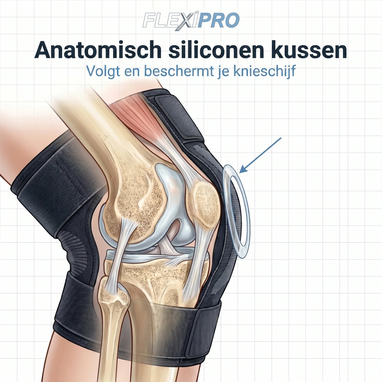Kniebeschermer voor vaklieden — de hele dag beschermd zonder pijn